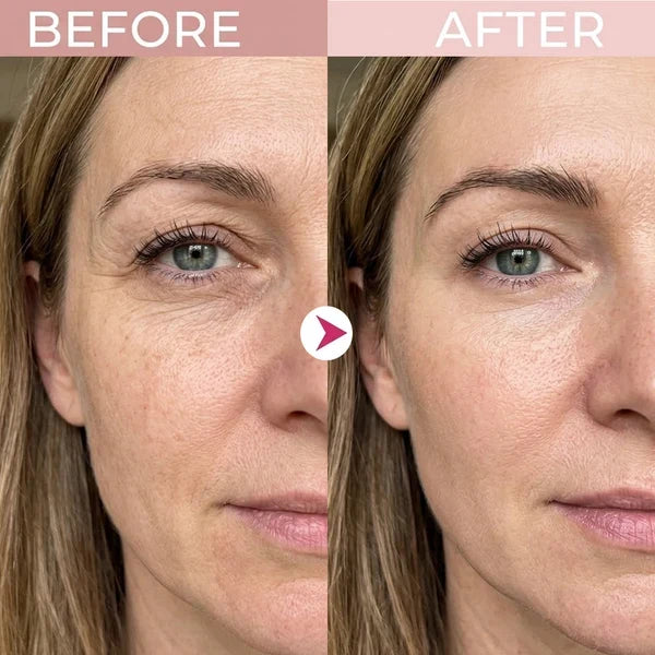 ⏳🔥Last Day-Buy 1 Get 1 Free🔥⏰P7 Eye Renewal Crème