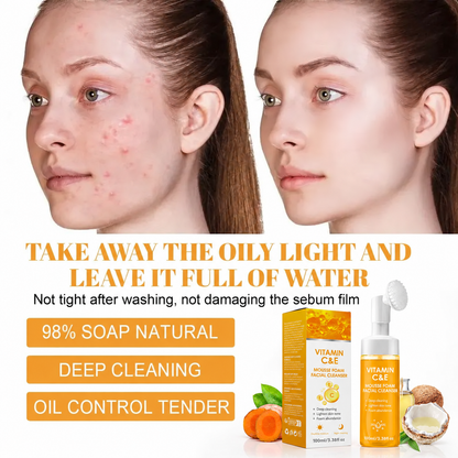 🔥Last Day-Buy 1 Get 1 Free🔥Turmeric + Kojic Acid Foaming Facial Cleanser with Silicone Brush