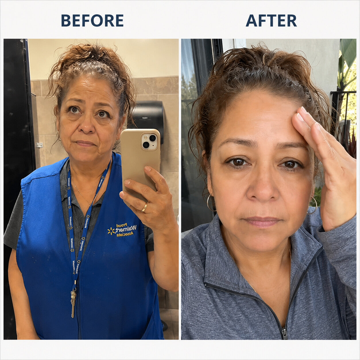 Customer before and after comparison showing the face and forehead