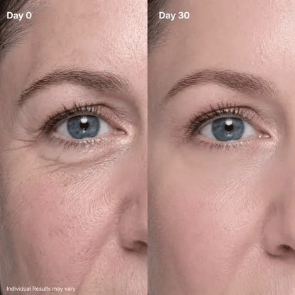 ⏳🔥Last Day-Buy 1 Get 1 Free🔥⏰P7 Eye Renewal Crème